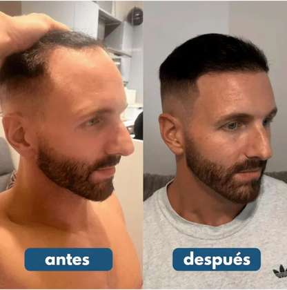 Capilux™ - Serum Roll On Crecimiento Capilar